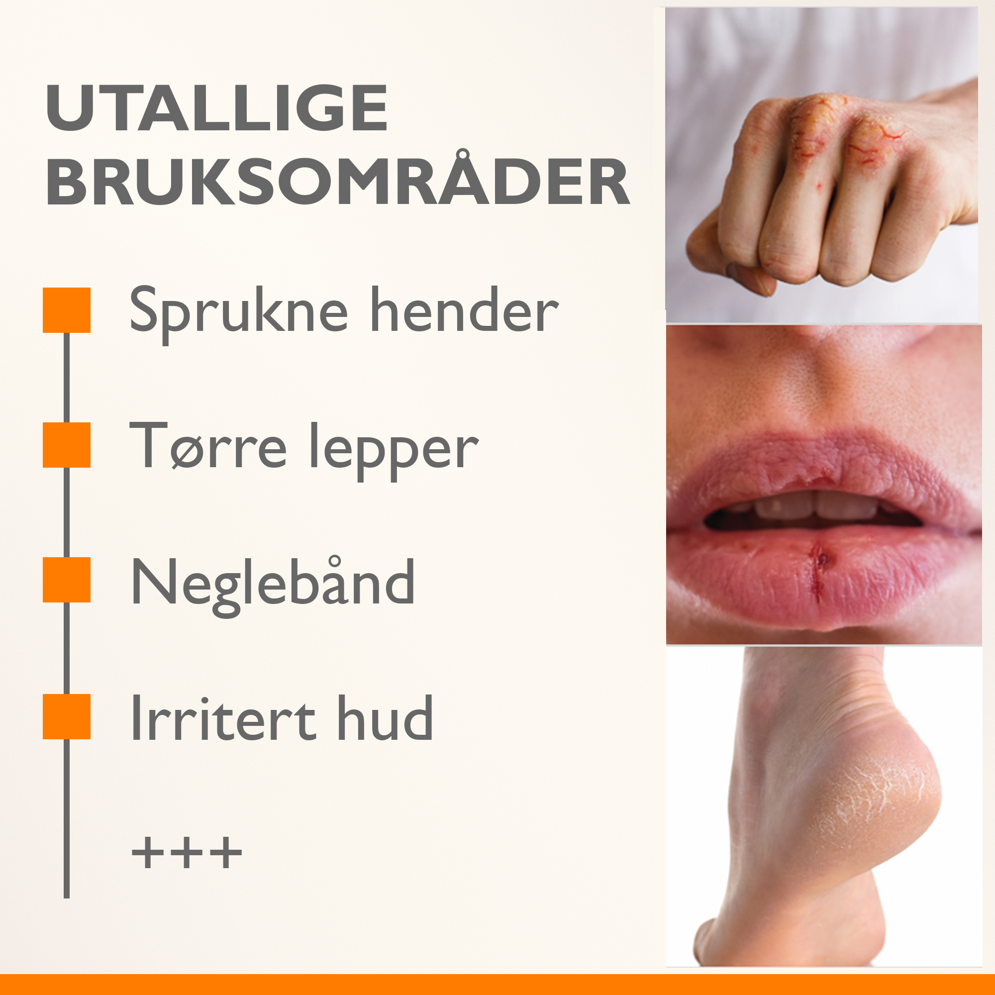 A-Derma Epitheliale Ultra Balm, 50 g