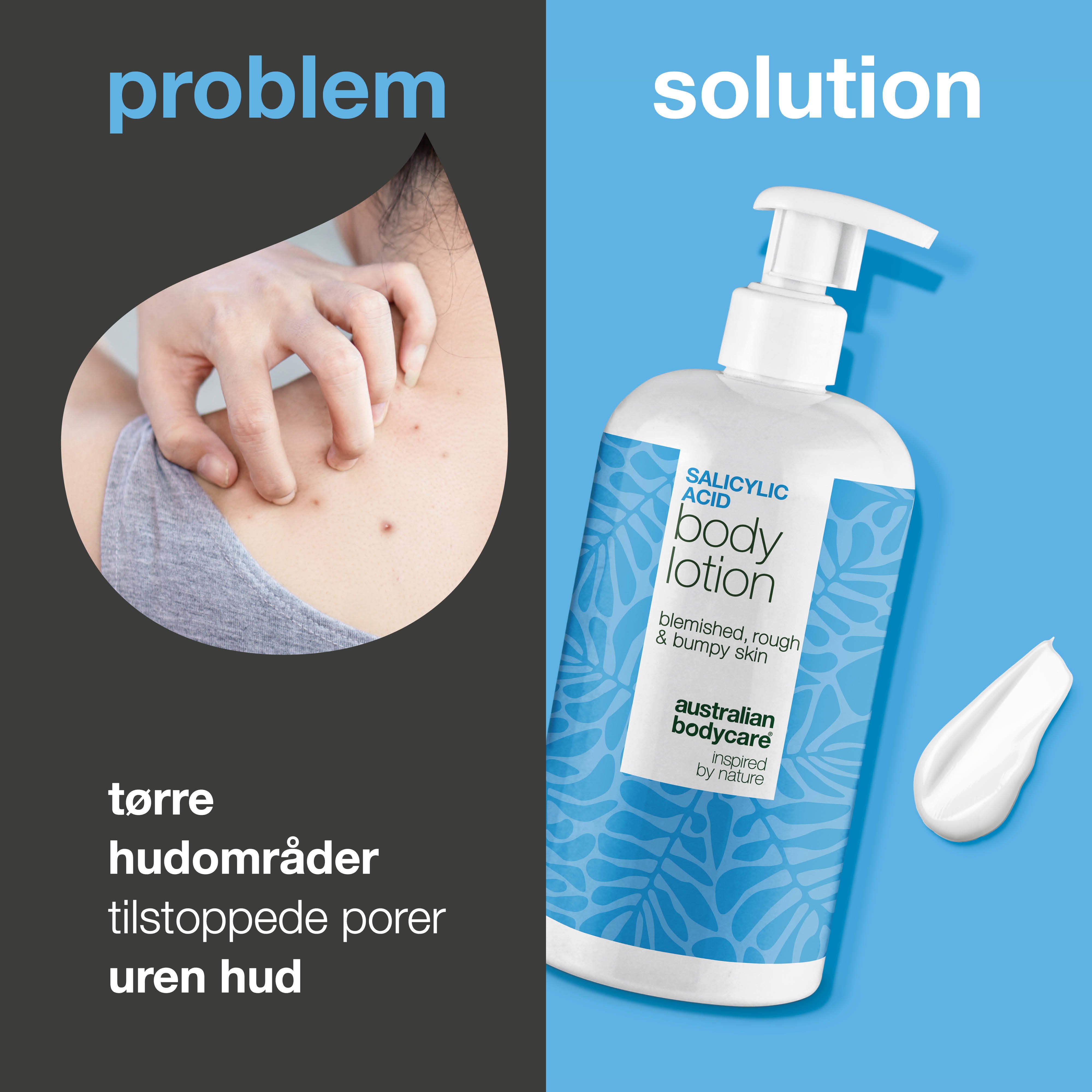 Australian Bodycare Salicylic Acid Body Lotion, 500 ml