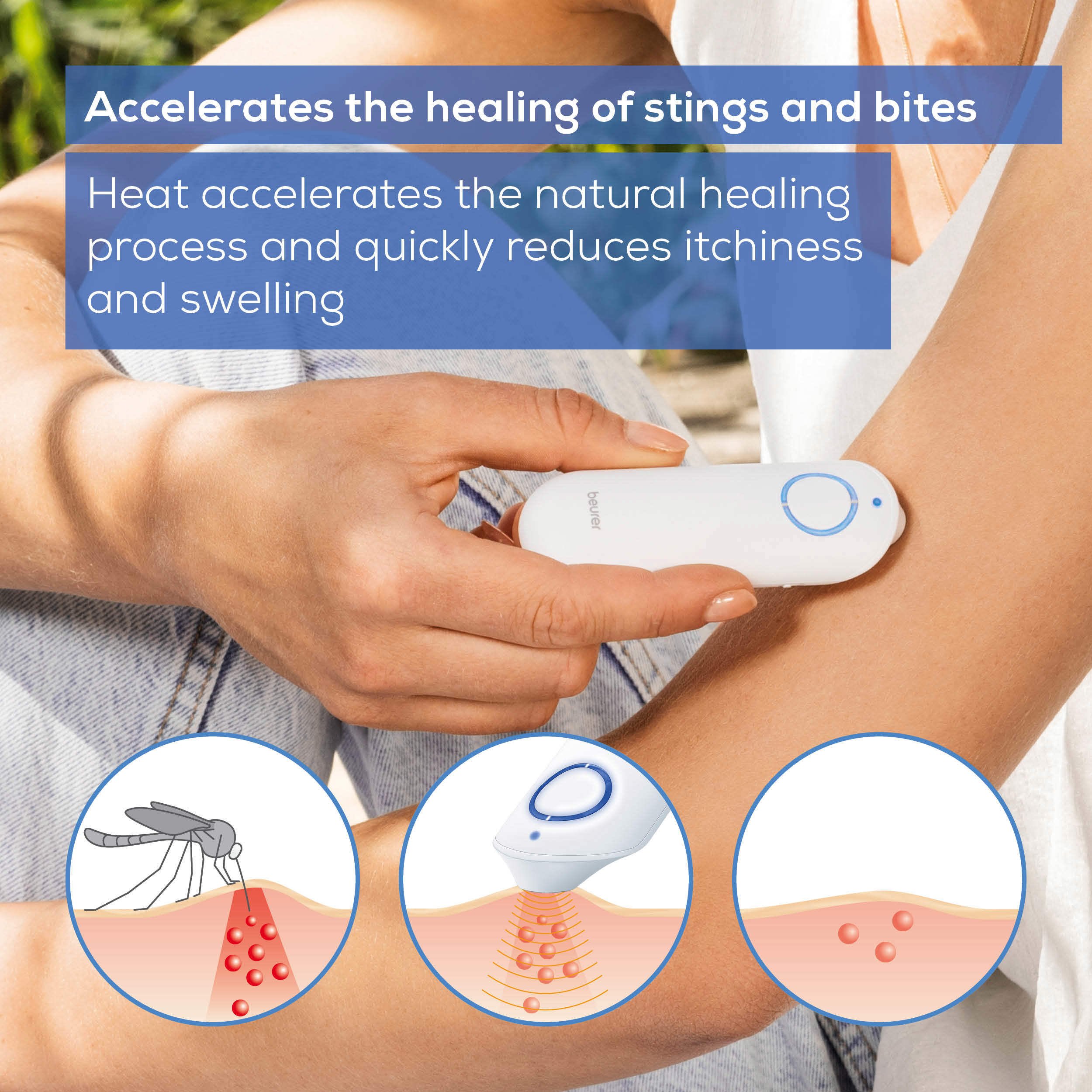 Beurer BR 60 Insektstikk-Healer, 1 stk.