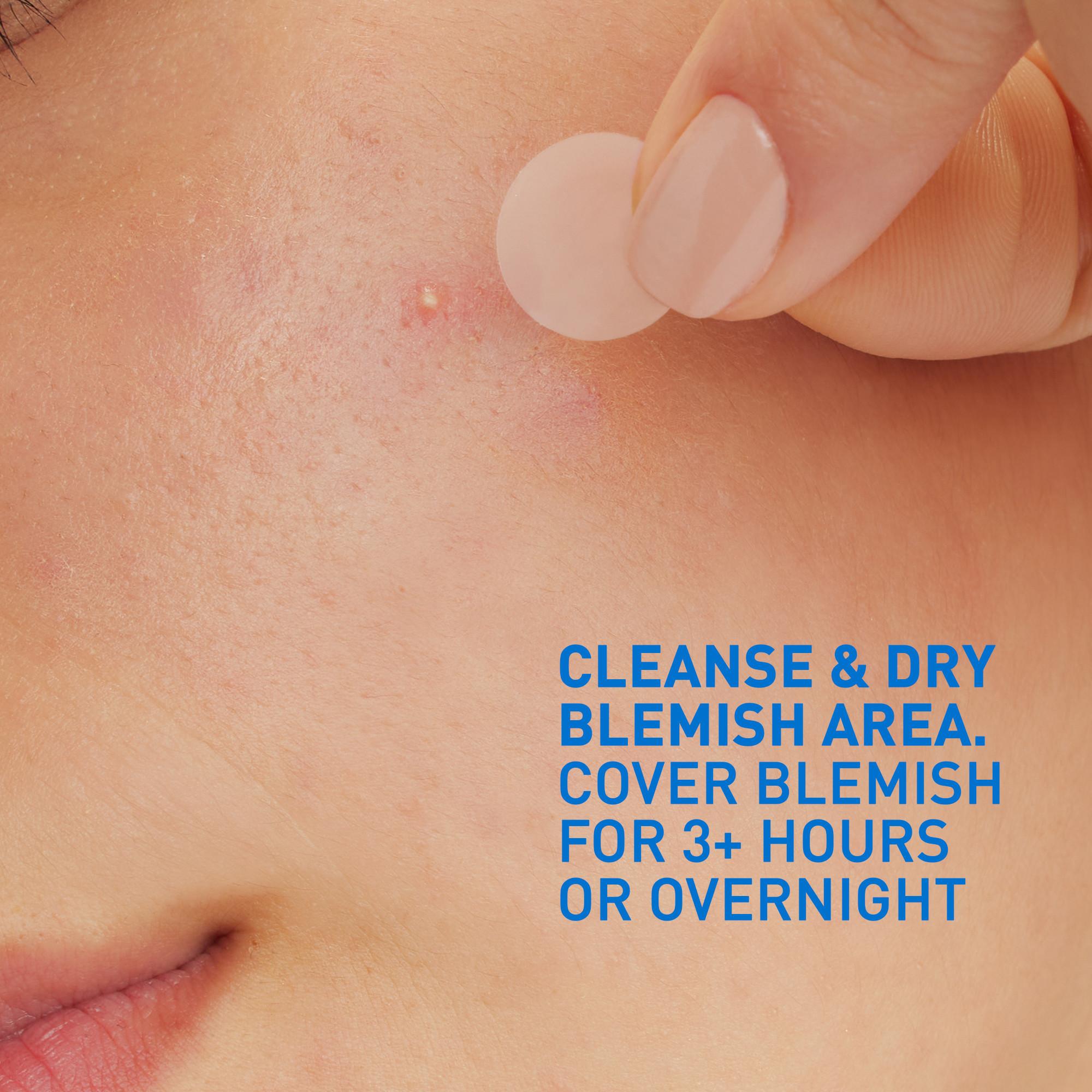 CeraVe Blemish Control Barrier Patches, 22 stk.