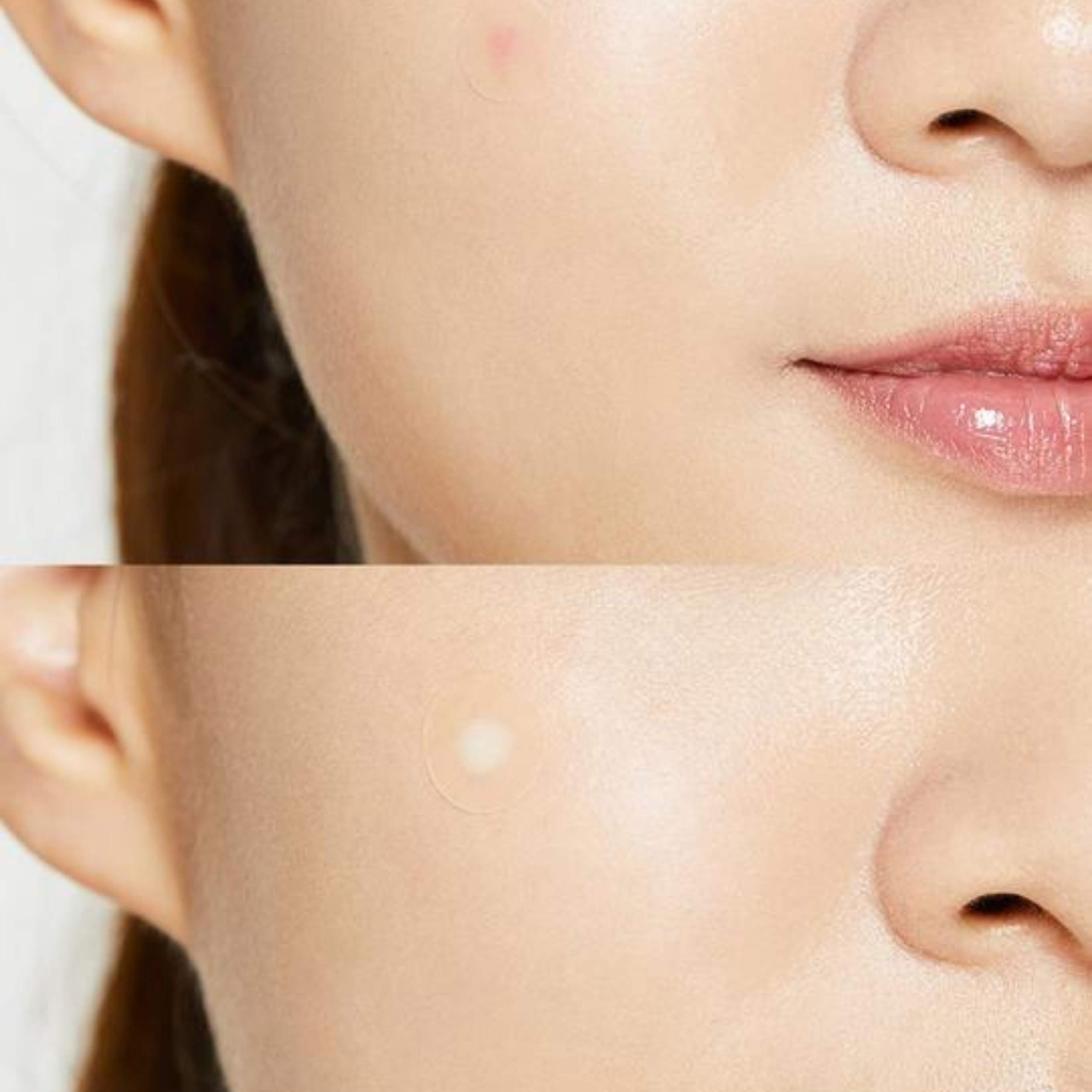 COSRX Acne Pimple Master Patch, 24 stk.