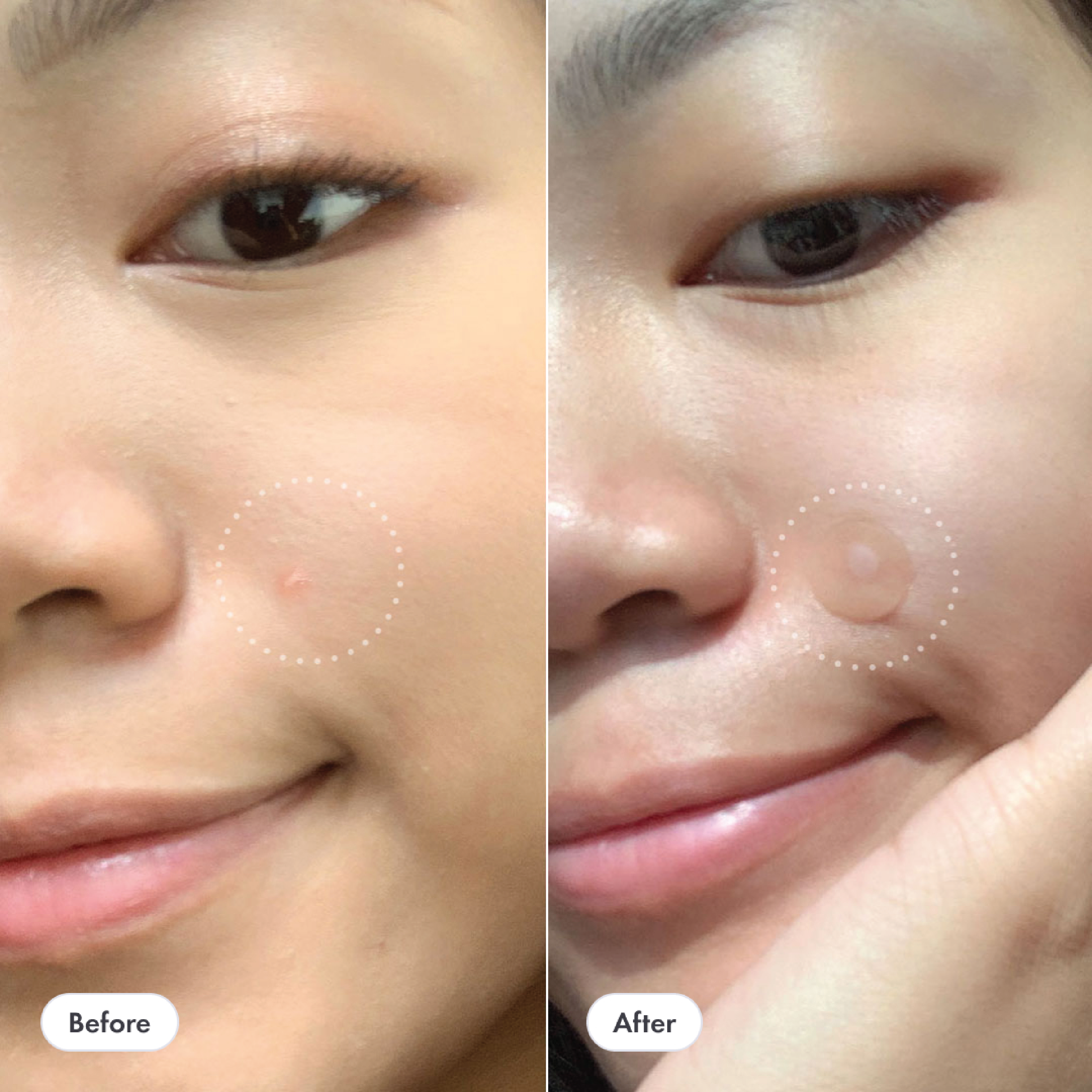 Hero Mighty Patch Invisible Plus, 24 stk.