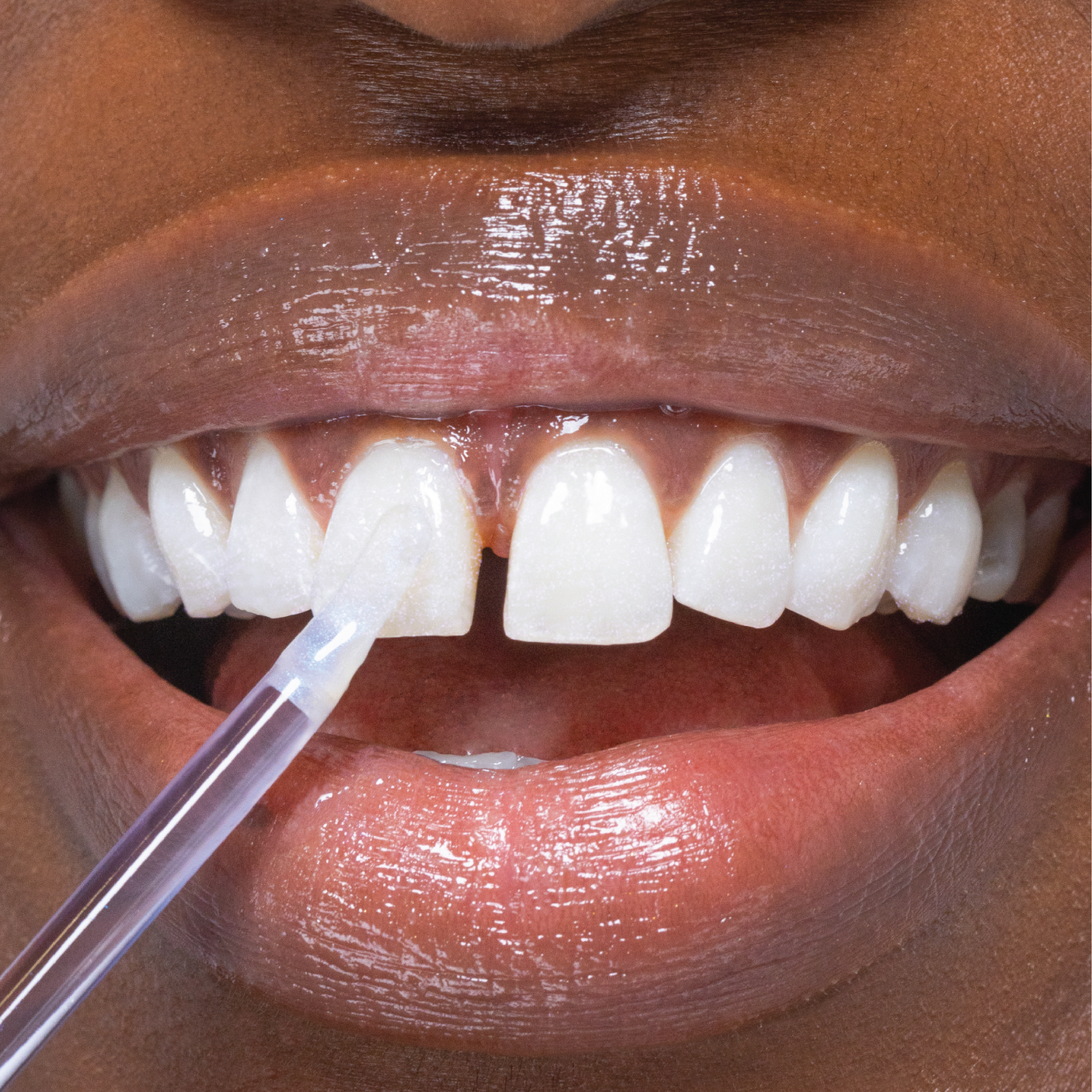 Hismile Glostik Tooth Gloss, 4 ml