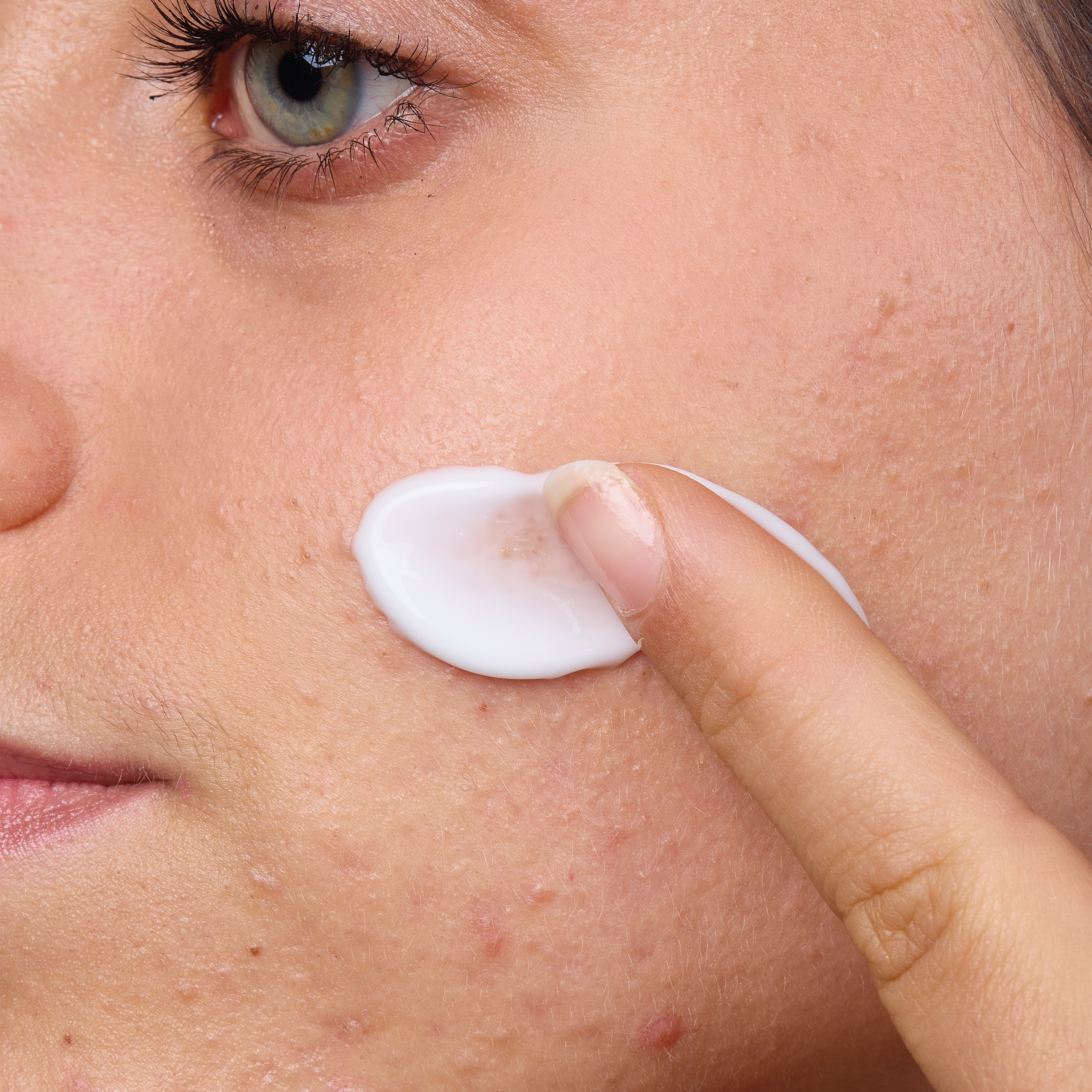 Isispharma Teen Derm A.Z Ansiktskrem, 30 ml