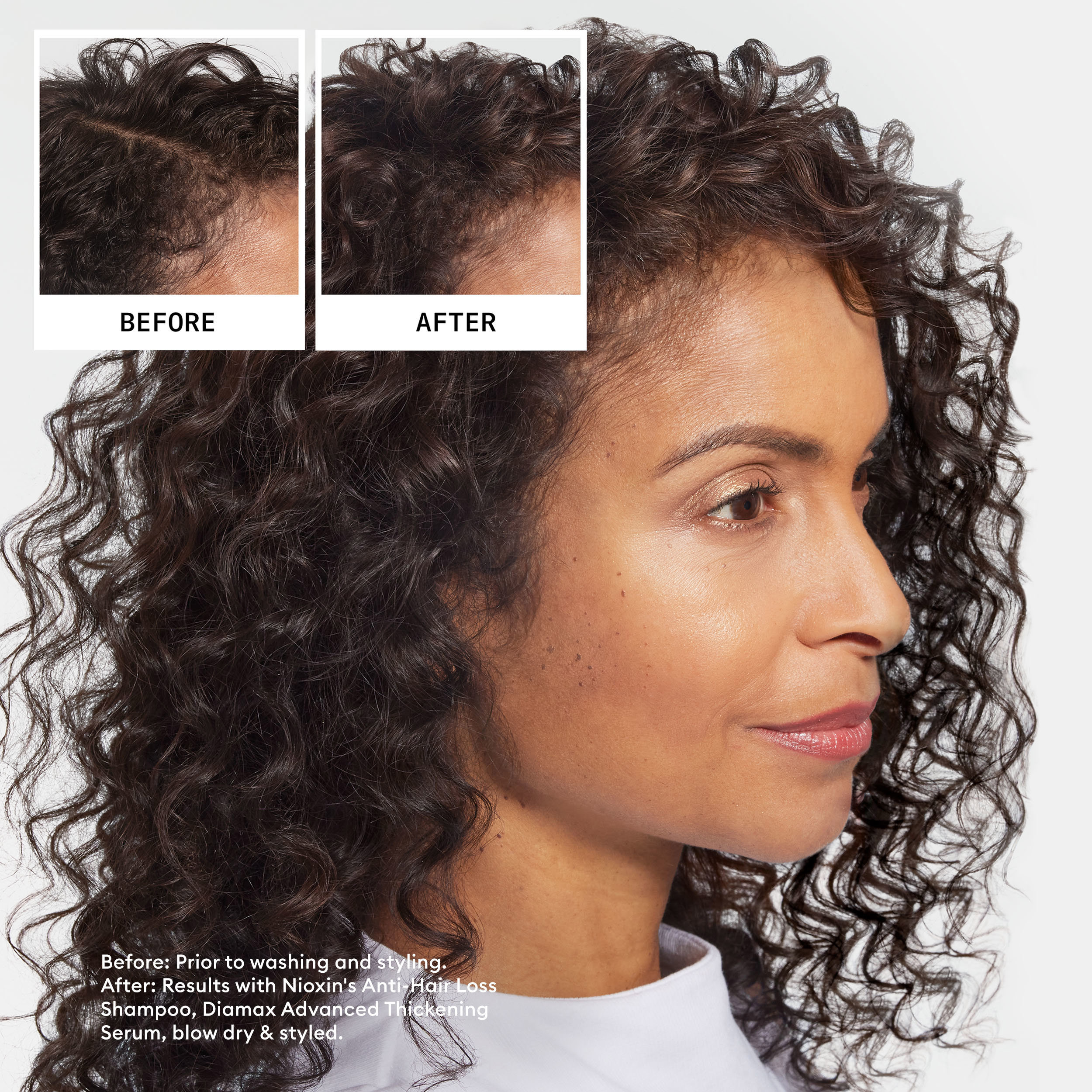 Nioxin Anti-Hair Loss Shampoo, 240 ml