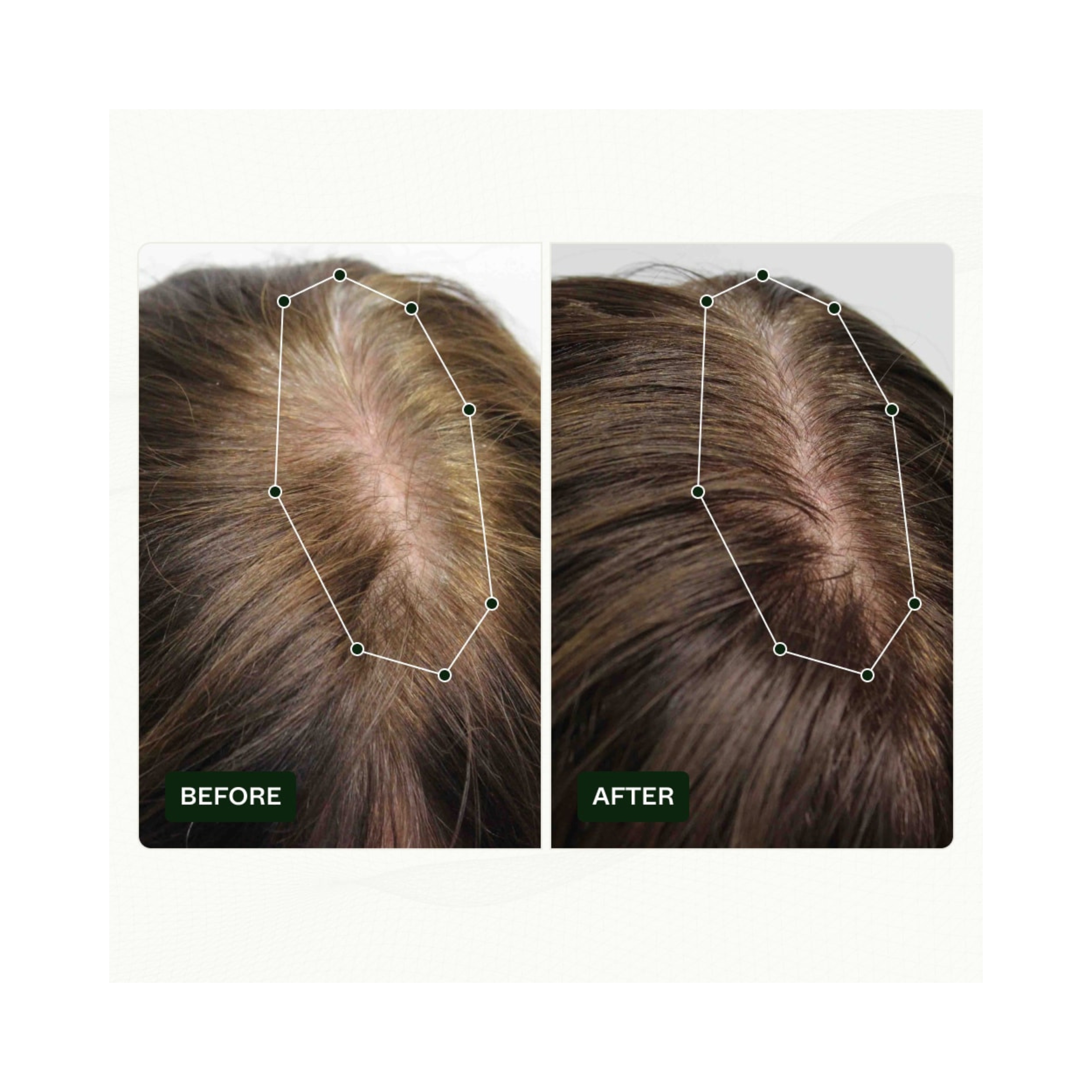 Scandinavian Biolabs Bio-Pilixin® Serum+ | For Women, 100 ml