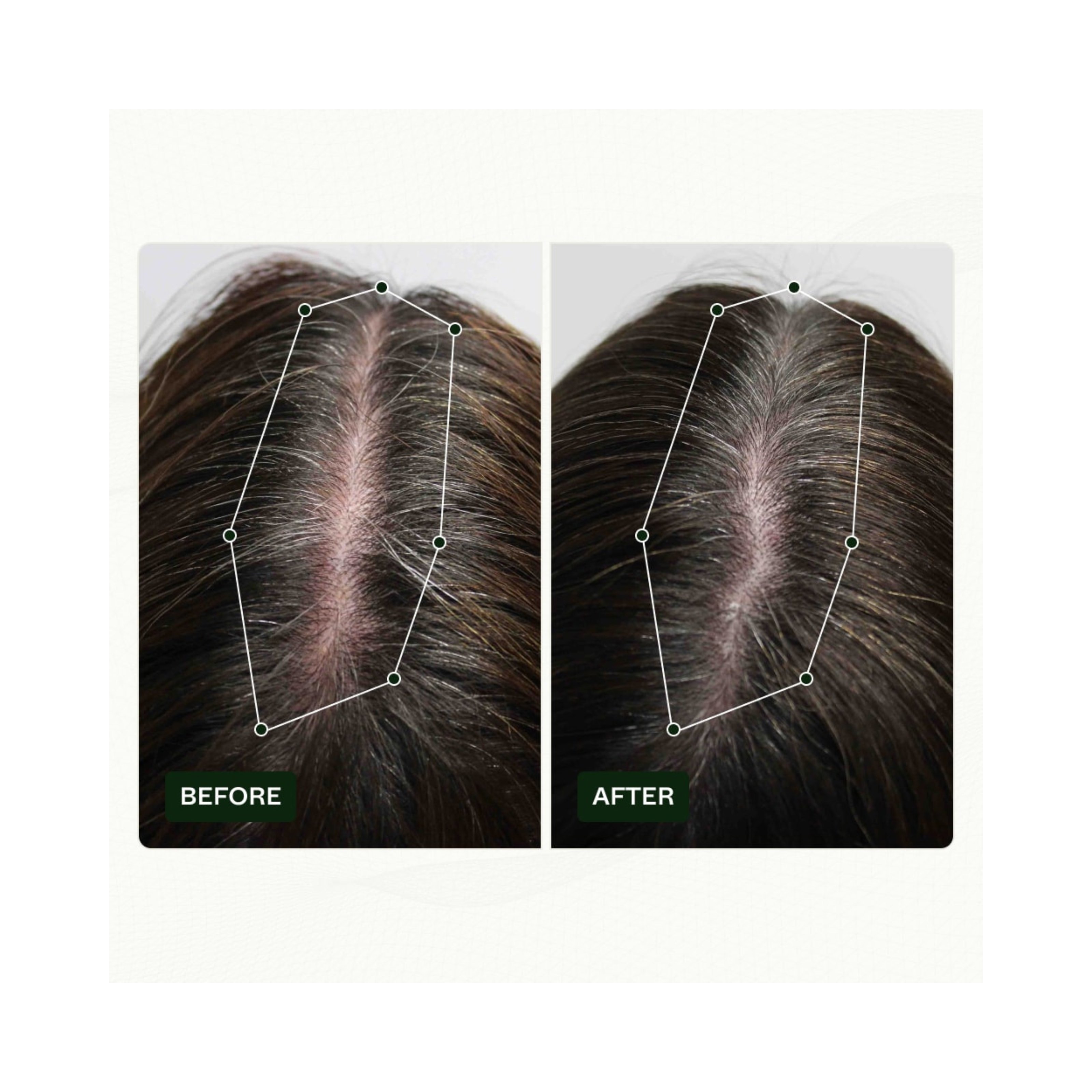 Scandinavian Biolabs Bio-Pilixin® Serum+ | For Women, 100 ml