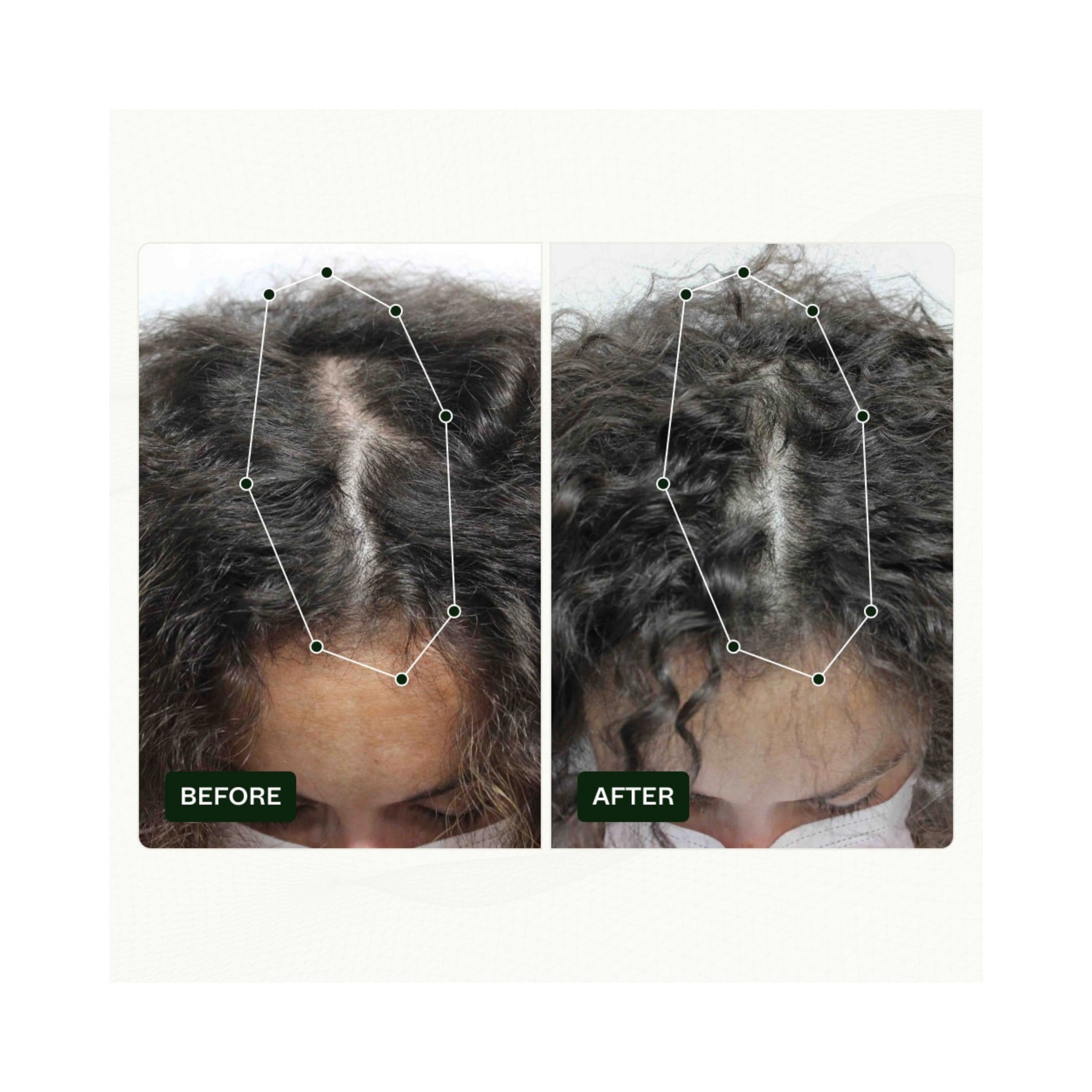 Scandinavian Biolabs Bio-Pilixin® Serum+ | For Women, 100 ml