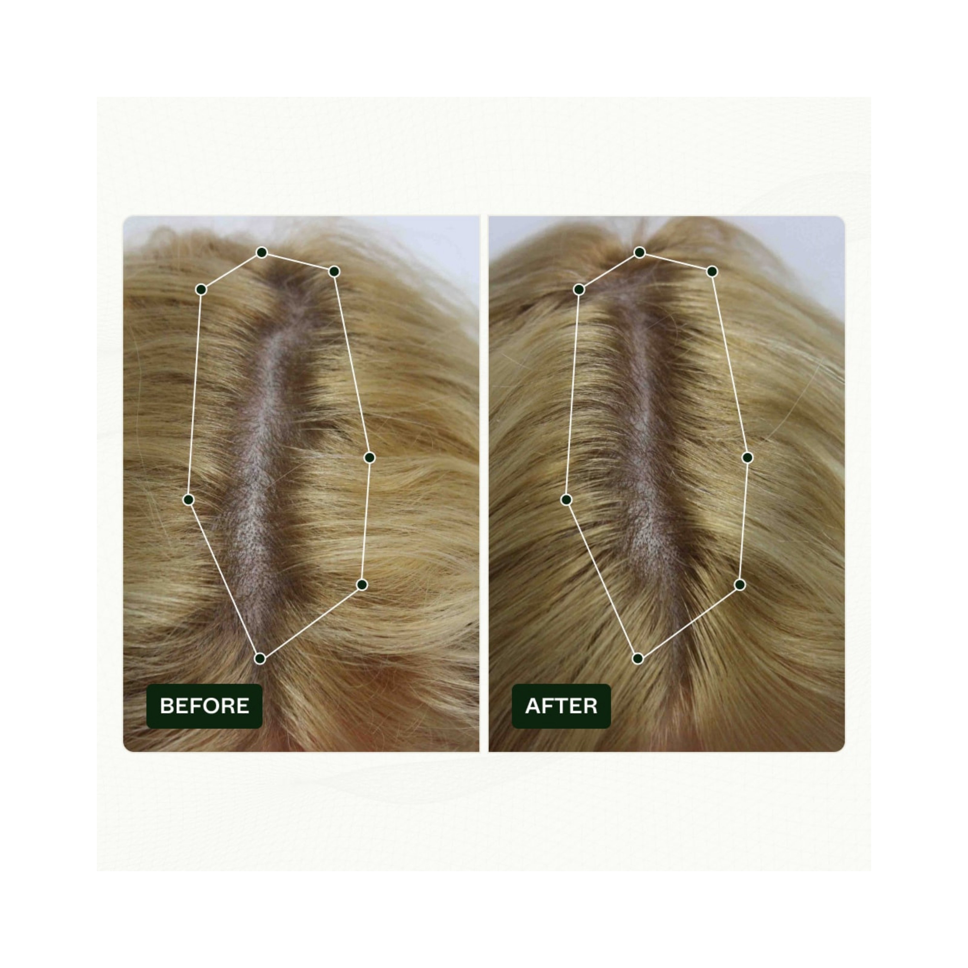 Scandinavian Biolabs Bio-Pilixin® Serum+ | For Women, 100 ml