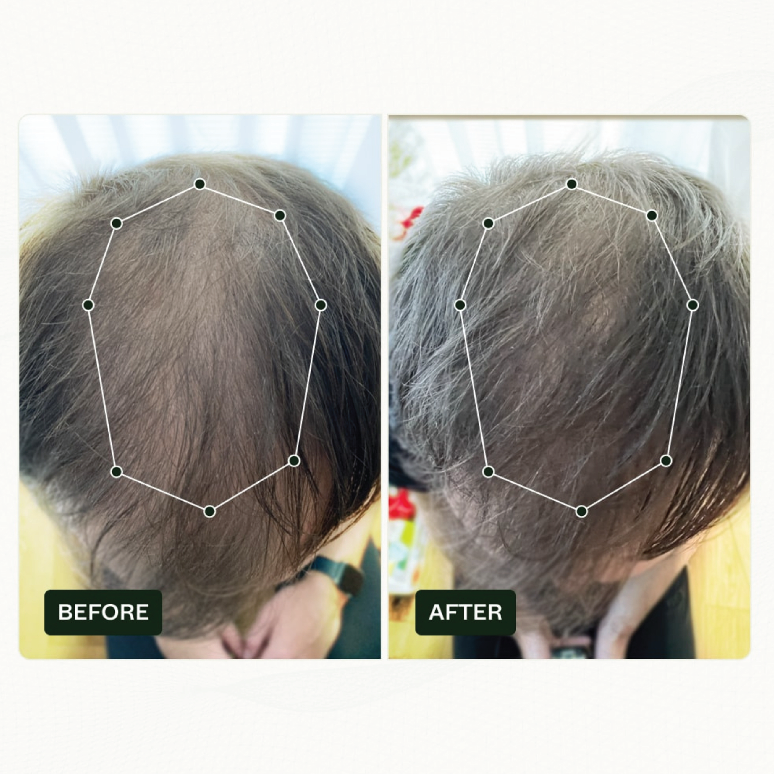 Scandinavian Biolabs Bio-Pilixin® Serum+ For Men, 100 ml