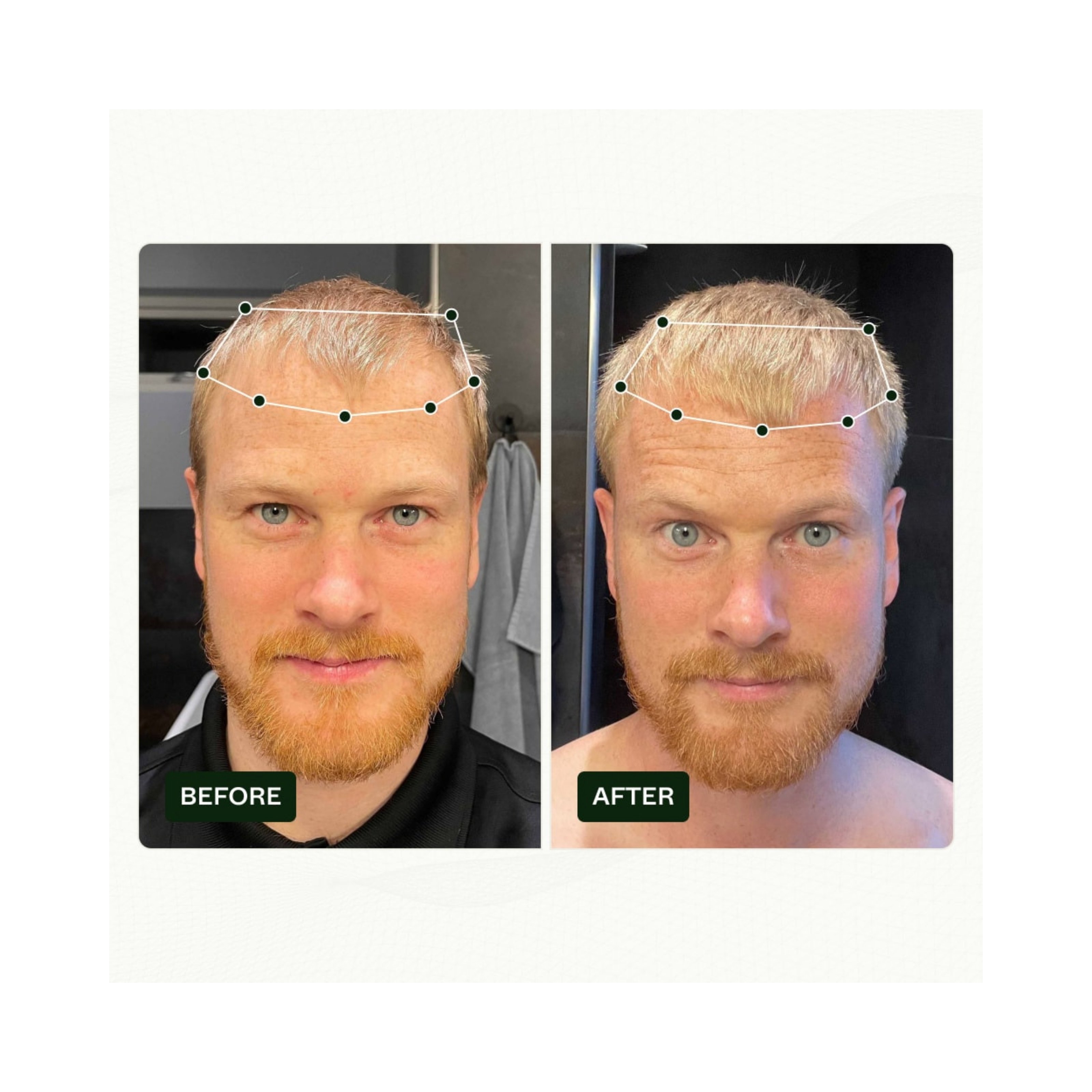 Scandinavian Biolabs Bio-Pilixin® Serum+ For Men, 100 ml