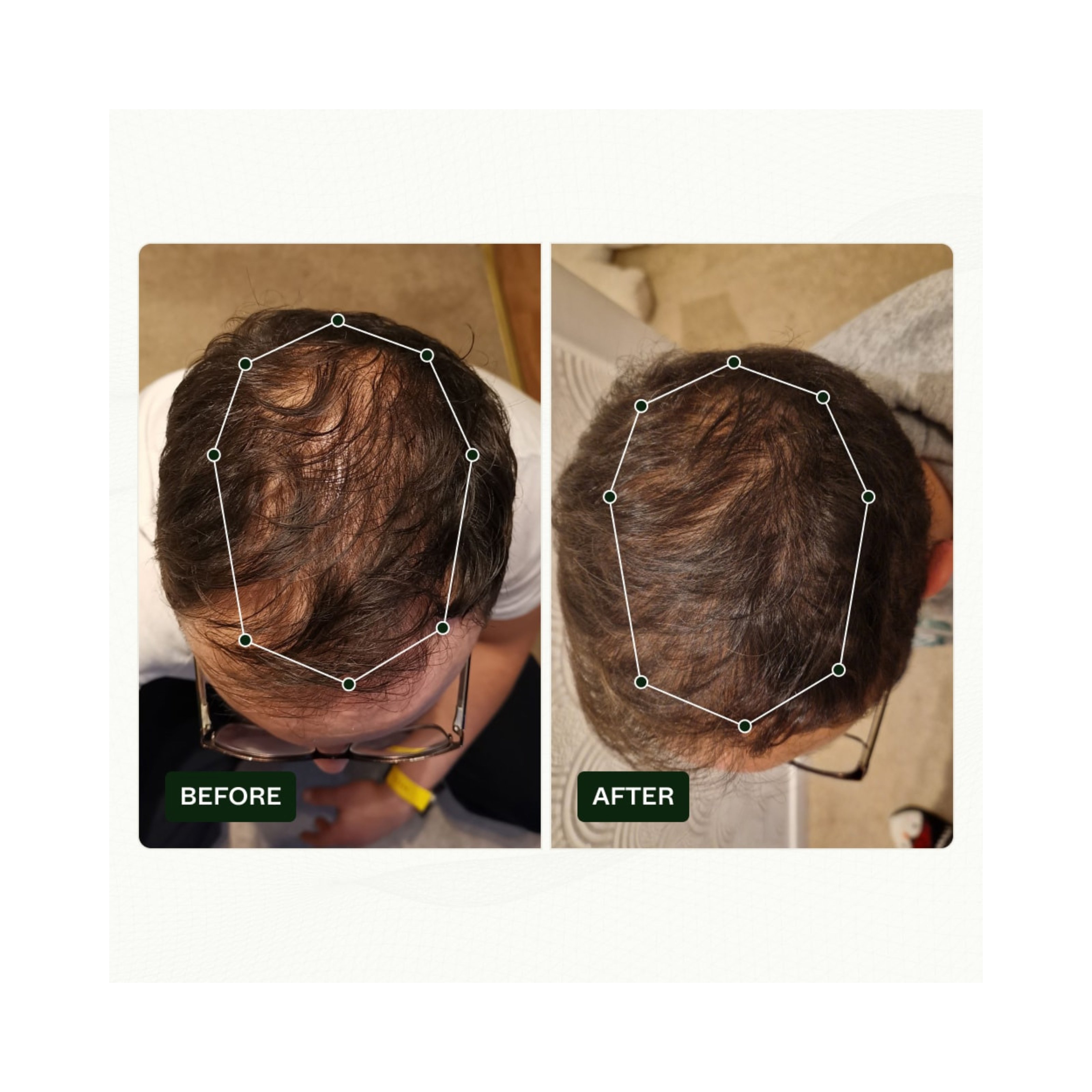 Scandinavian Biolabs Bio-Pilixin® Serum+ For Men, 100 ml