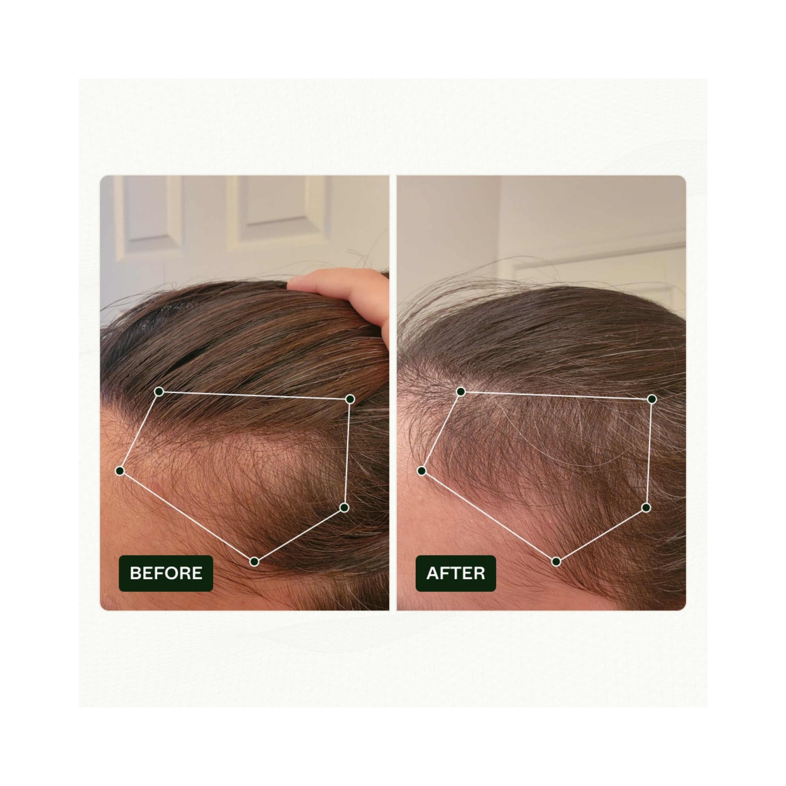 Scandinavian Biolabs Bio-Pilixin® Serum+ For Men, 100 ml