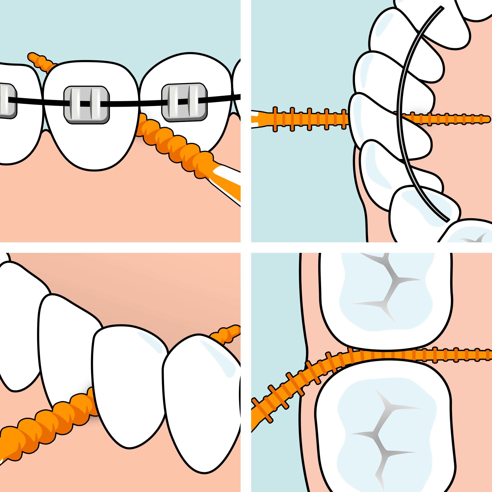 TePe EasyPick tannpirker, XL, 36 stk.