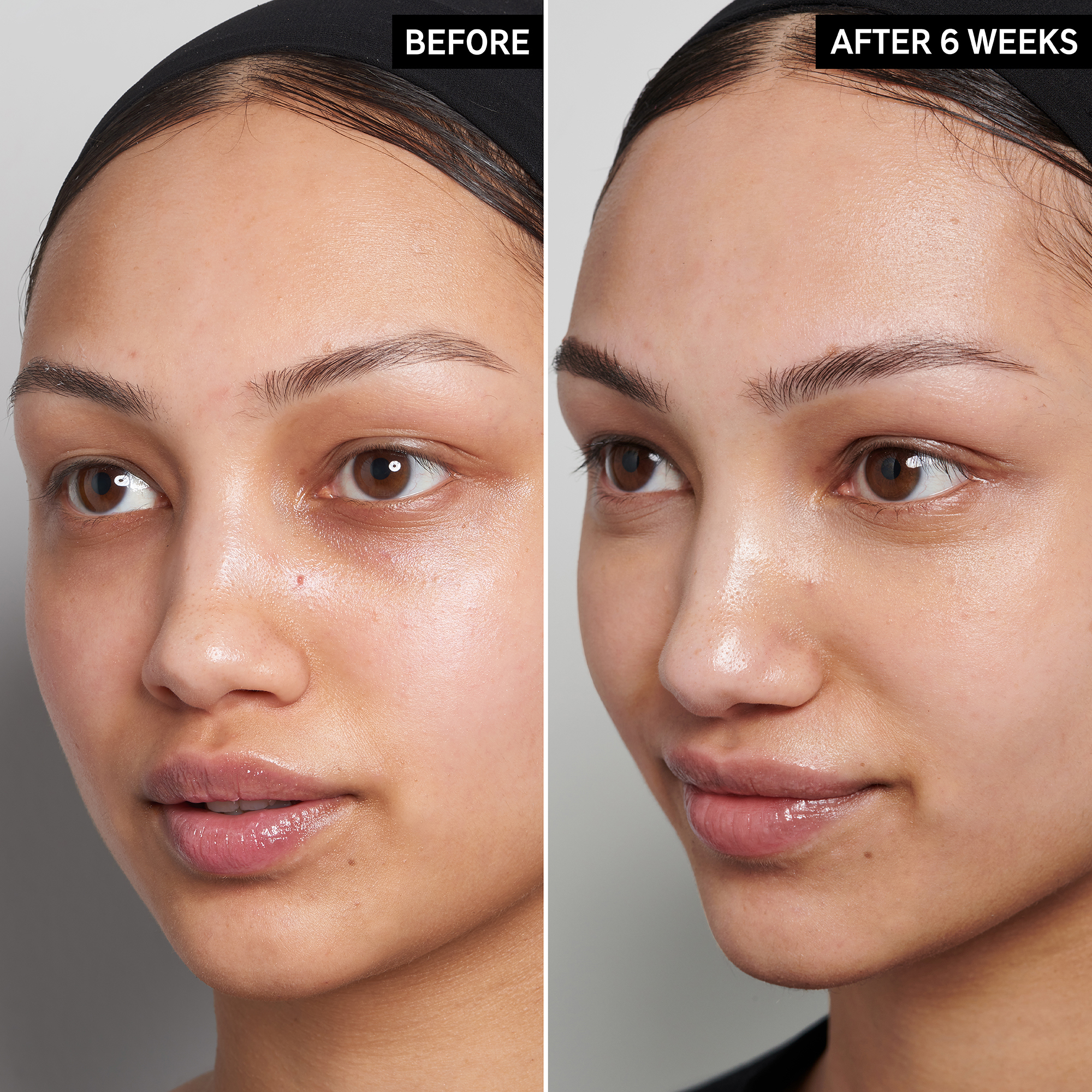 The Inkey List 15% Vitamin C and EGF Serum, 30 ml