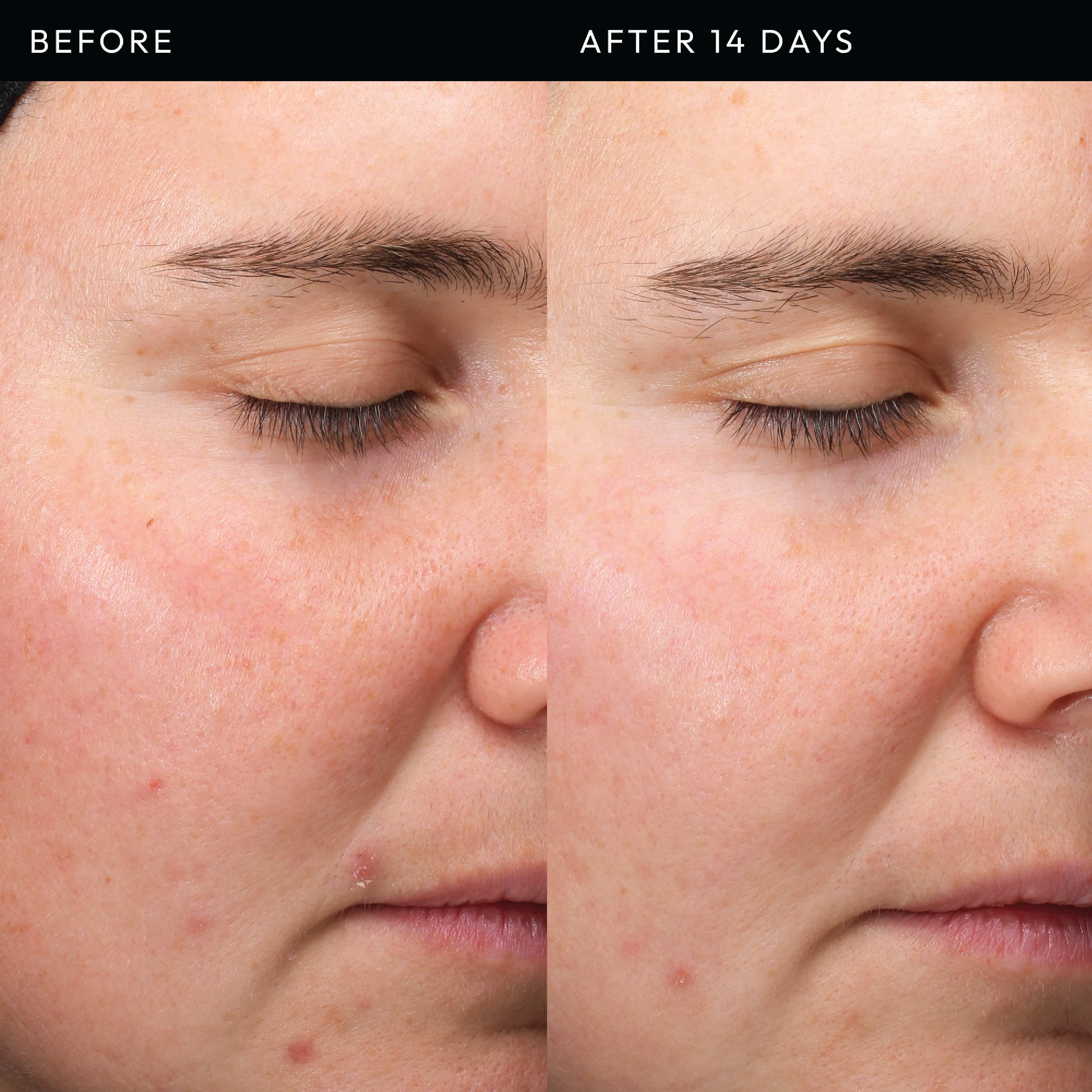 The Inkey List Exosome Hydro-Glow Complex, 30 ml