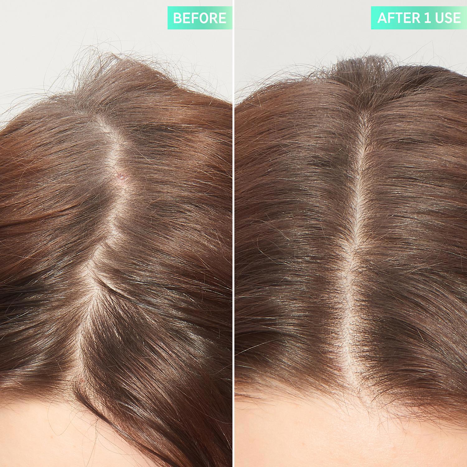 The Inkey List Glycolic Acid Exfoliating Scalp Scrub, 150 ml