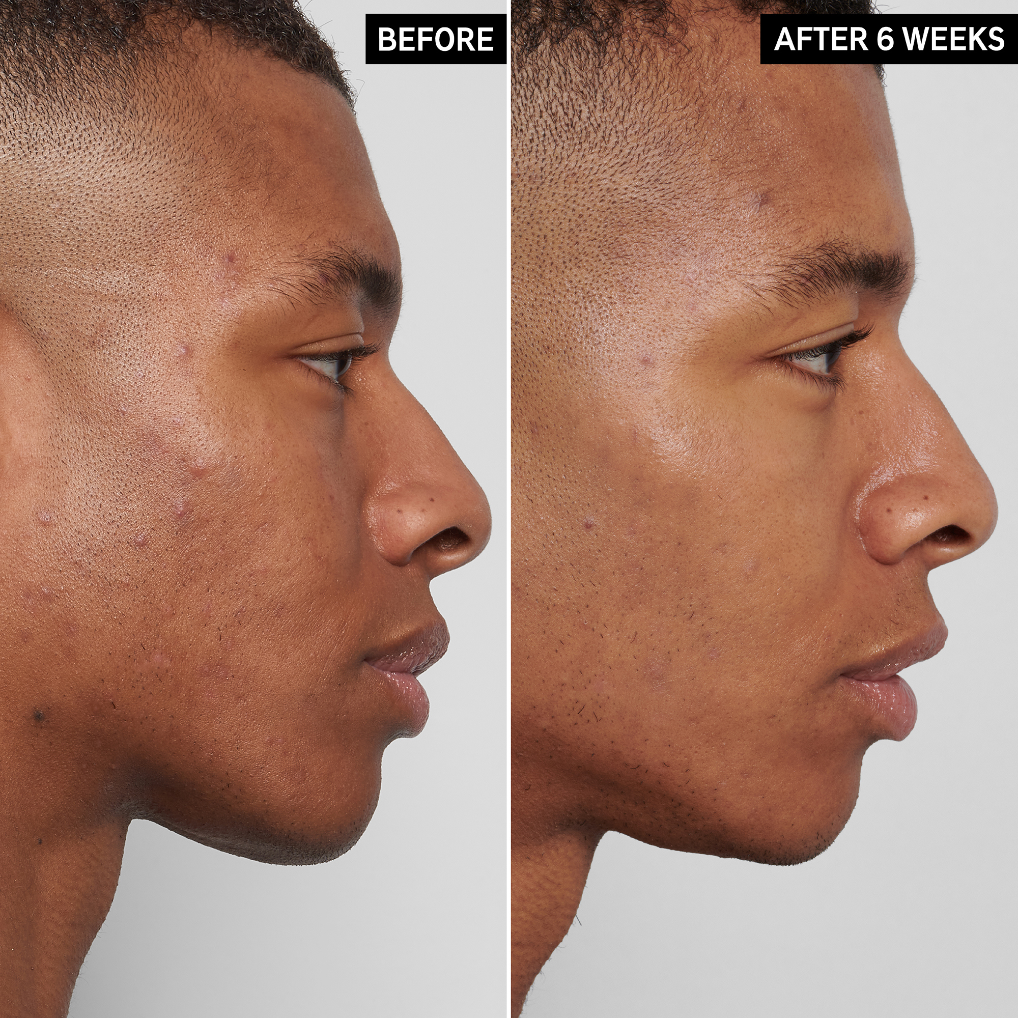 The Inkey List Mandelic Acid Treatment, 15 ml