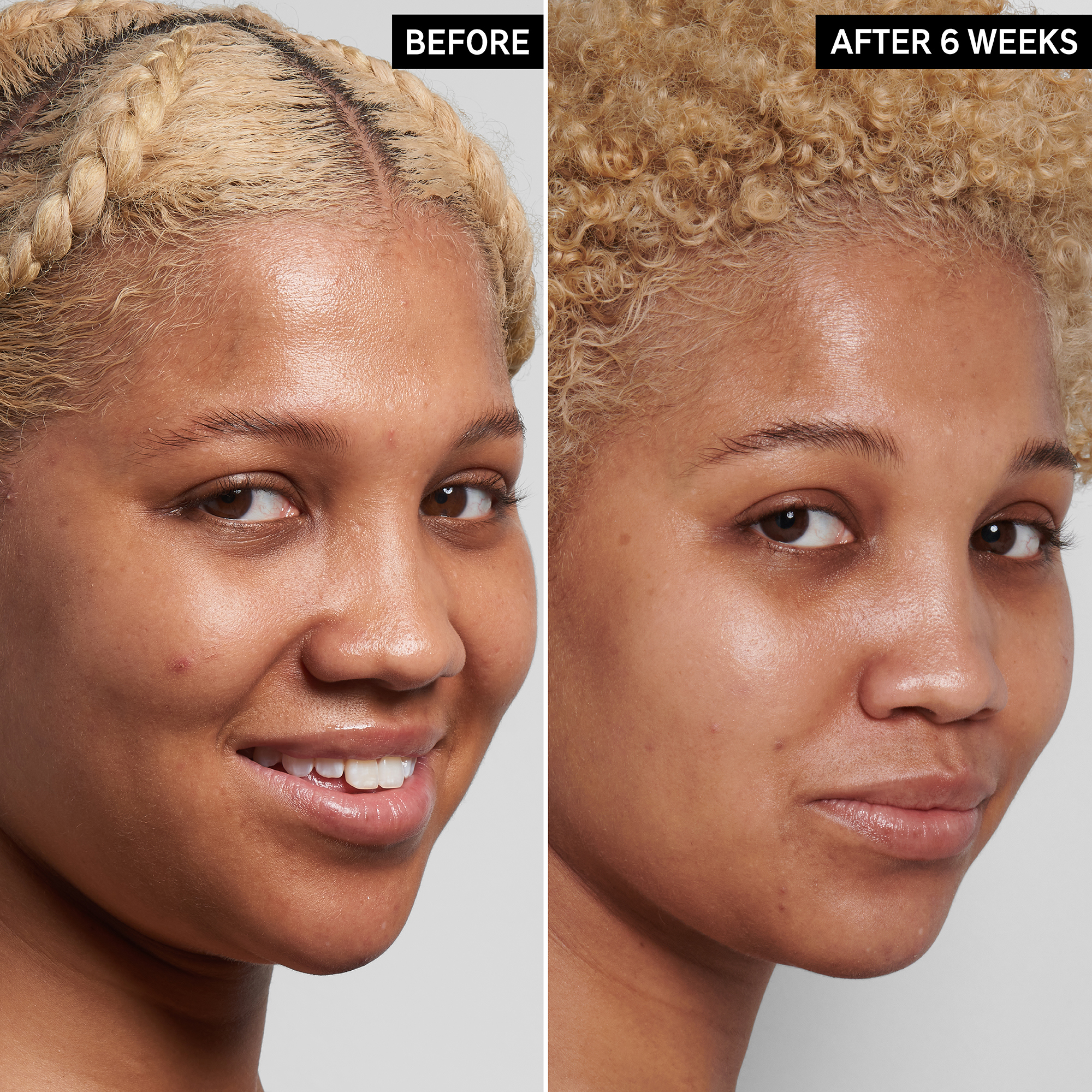 The Inkey List Niacinamide Serum, 30 ml