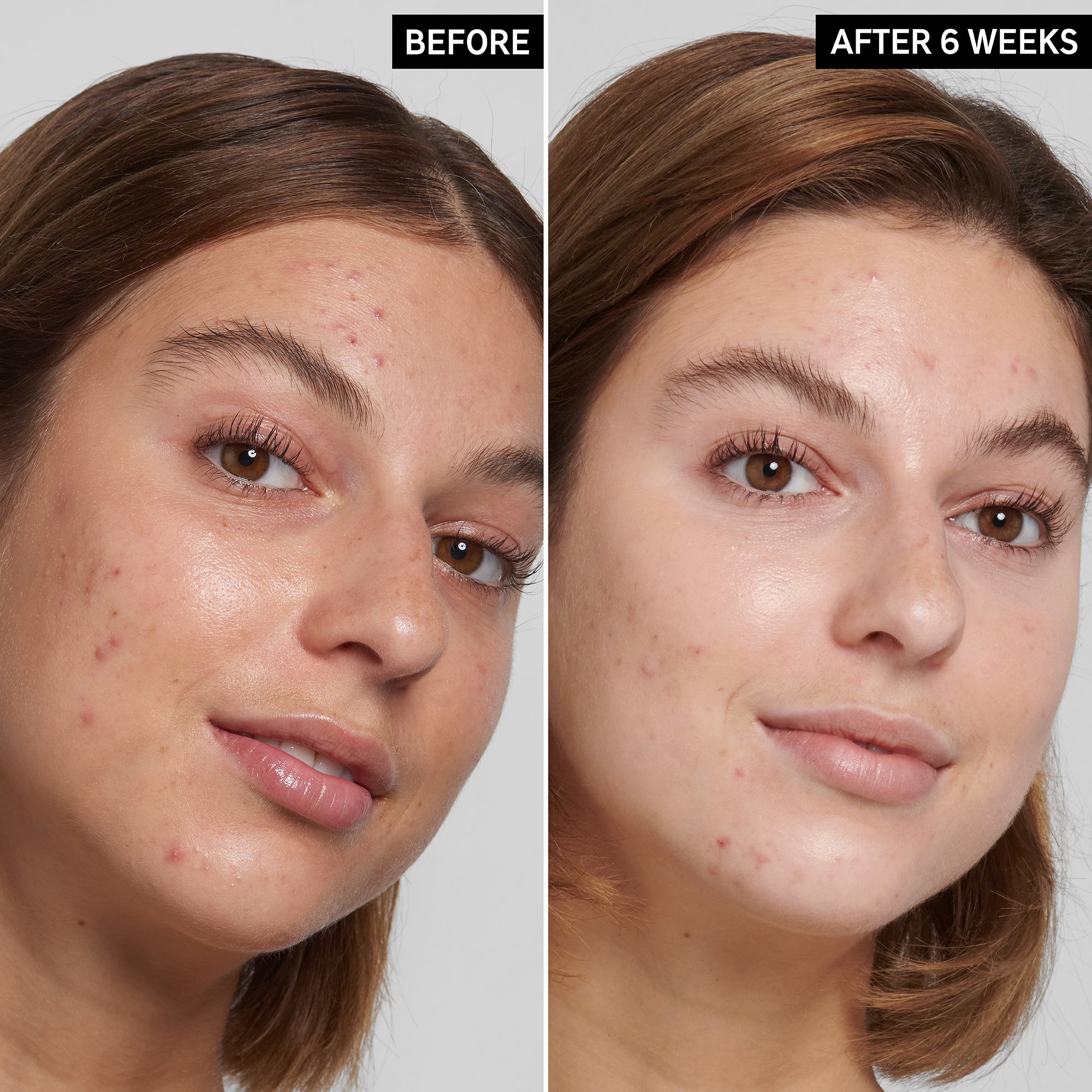 The Inkey List Salicylic Acid Cleanser, 150 ml