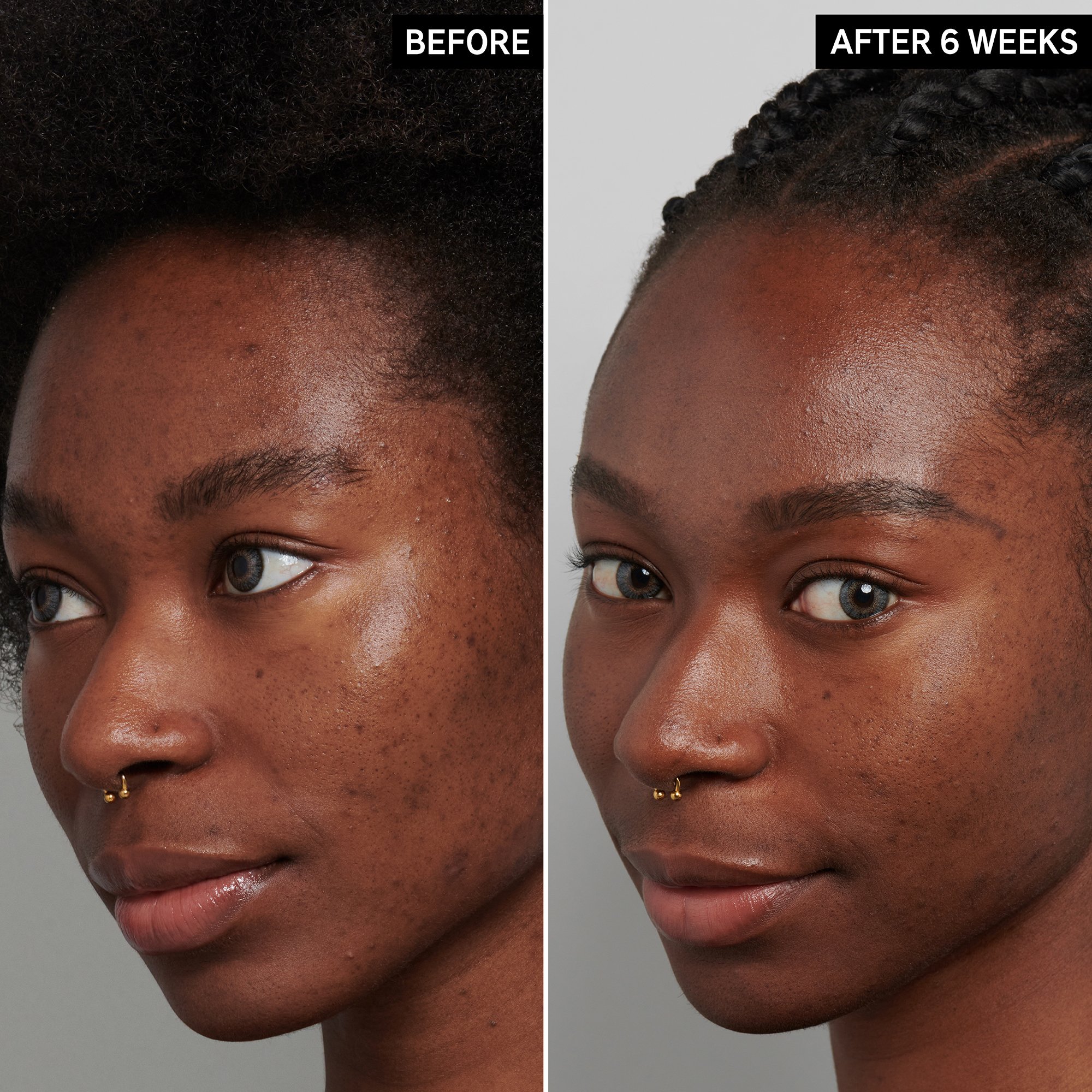 The Inkey List Tranexamic Acid Serum, 30 ml