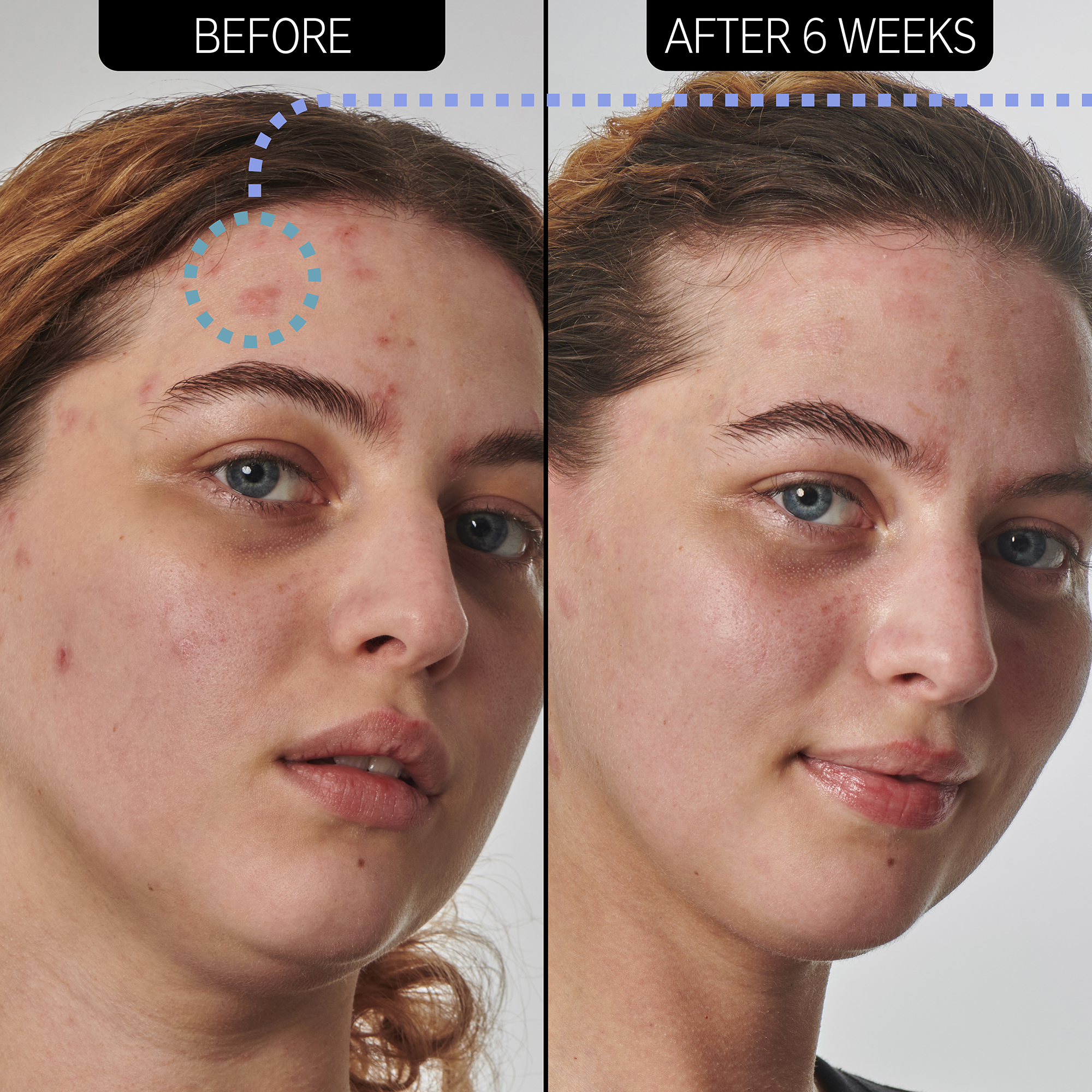 The Inkey List Urea 10% Moisturizer, 50 ml