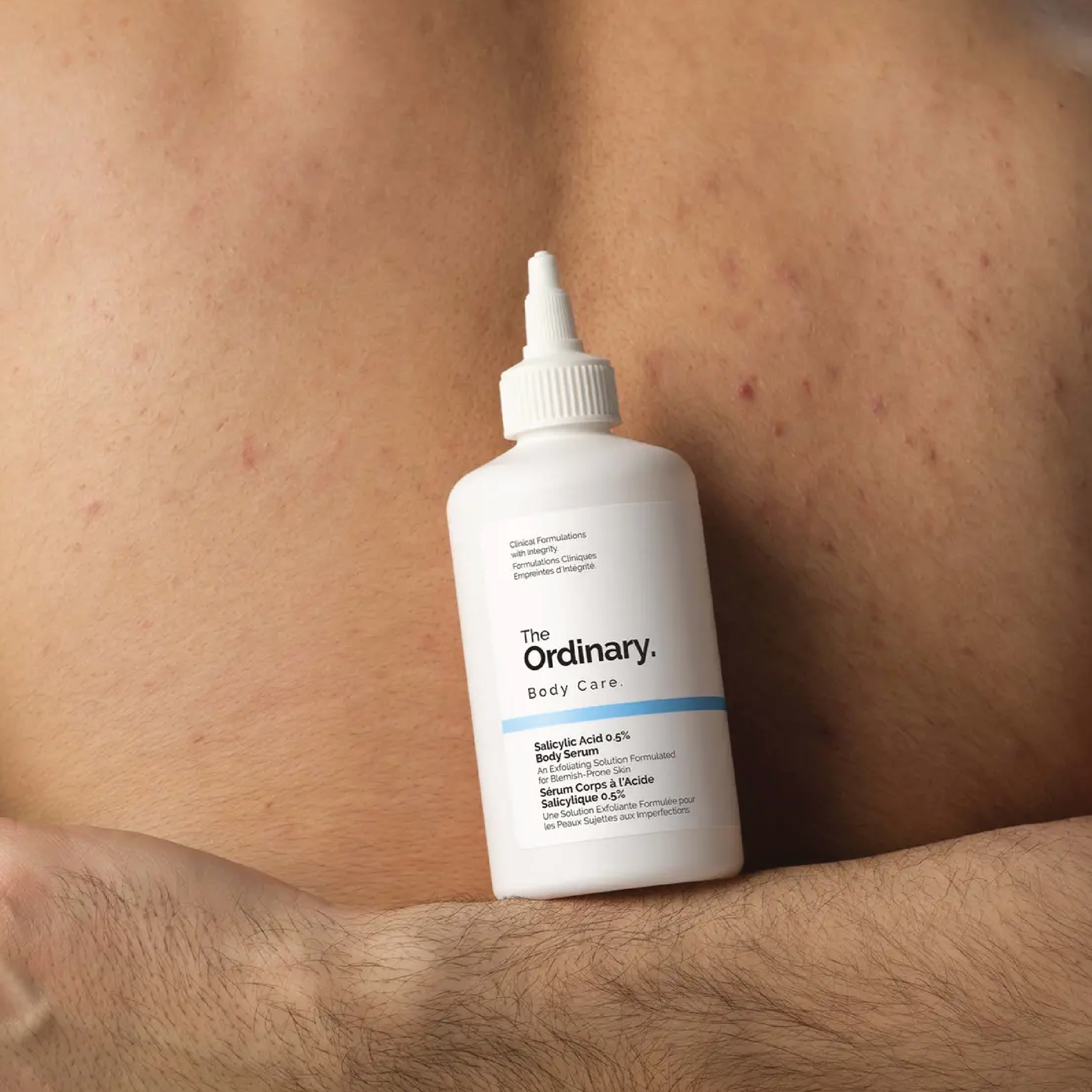 The Ordinary Salicylic Acid 0.5% Body Serum, 240 ml