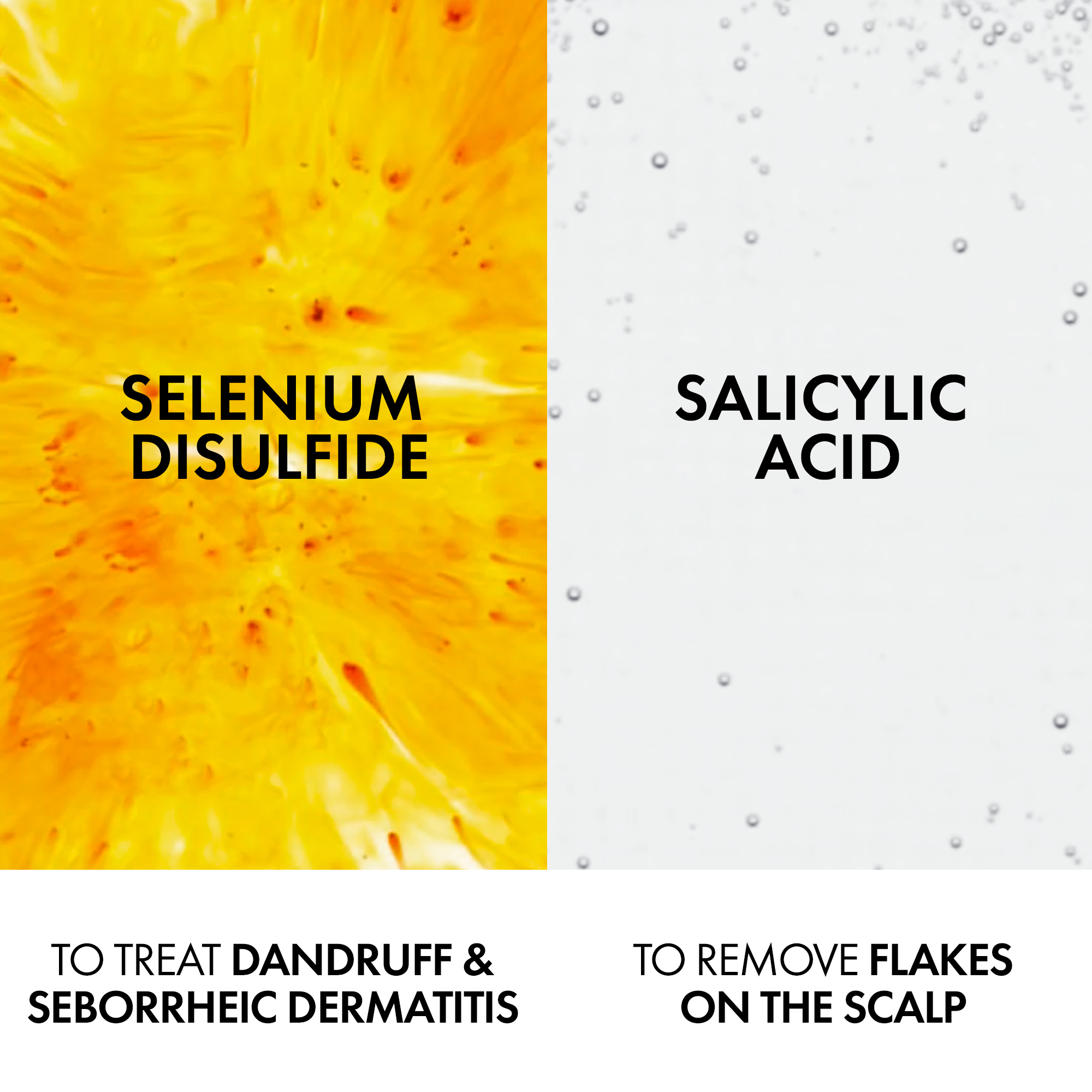 Vichy Dercos Anti-Dandruff Shampoo for Dry Hair, 200 ml